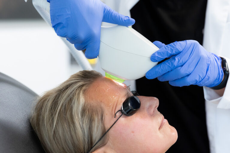A Radiant Divine patient is treated with an IPL laser in Cleveland