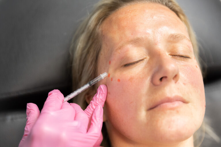 Radiant Divine injectors provide instructions for Botox aftercare in Cleveland during treatment sessions